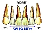 תמונה של מרווח בין ניבי בשיניים