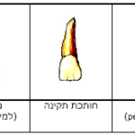 שיניים לא ישרות עקב גודל השן