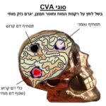 brain CVA