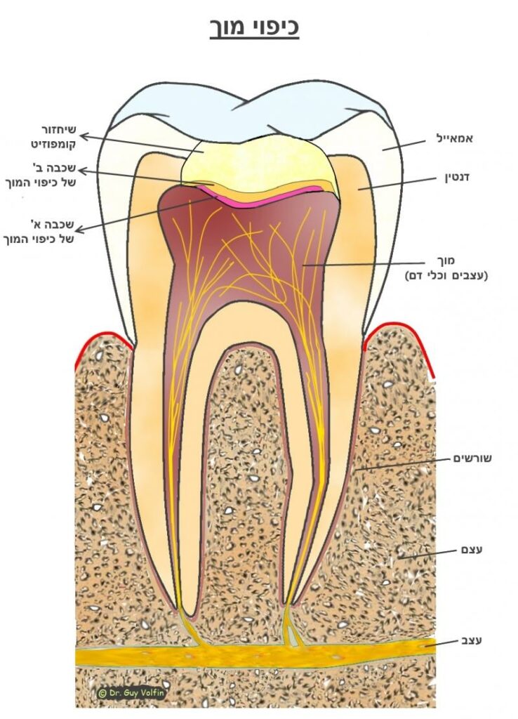 מאמר כיפוי מוך: האם אפשר "להציל" שן עם חור עמוק מביצוע טיפול שורש? מהו התהליך, מתי מבצעים ולמה?